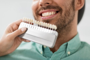 Dentist comparing a set of veneers to a patient’s smile